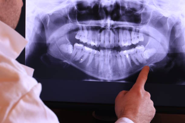 Best Emergency Root Canal Treatment in River Ridge, LA