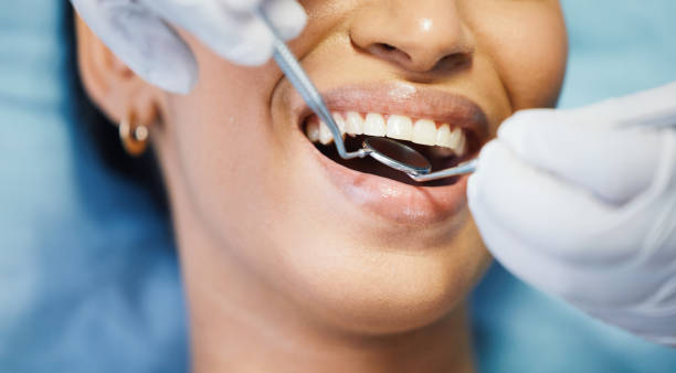 Best Emergency Tooth Extraction in River Ridge, LA