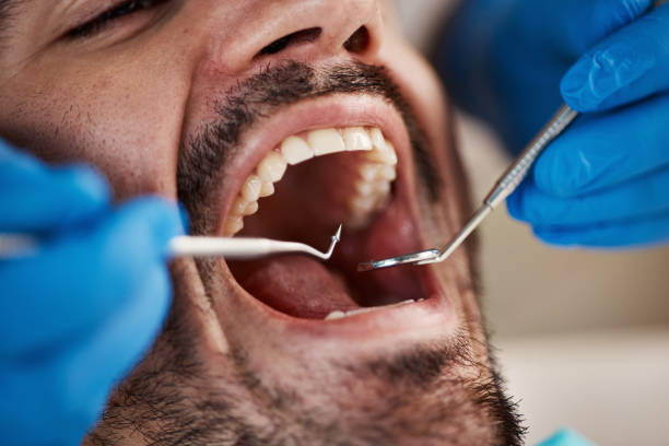 Best Emergency Root Canal Treatment in River Ridge, LA